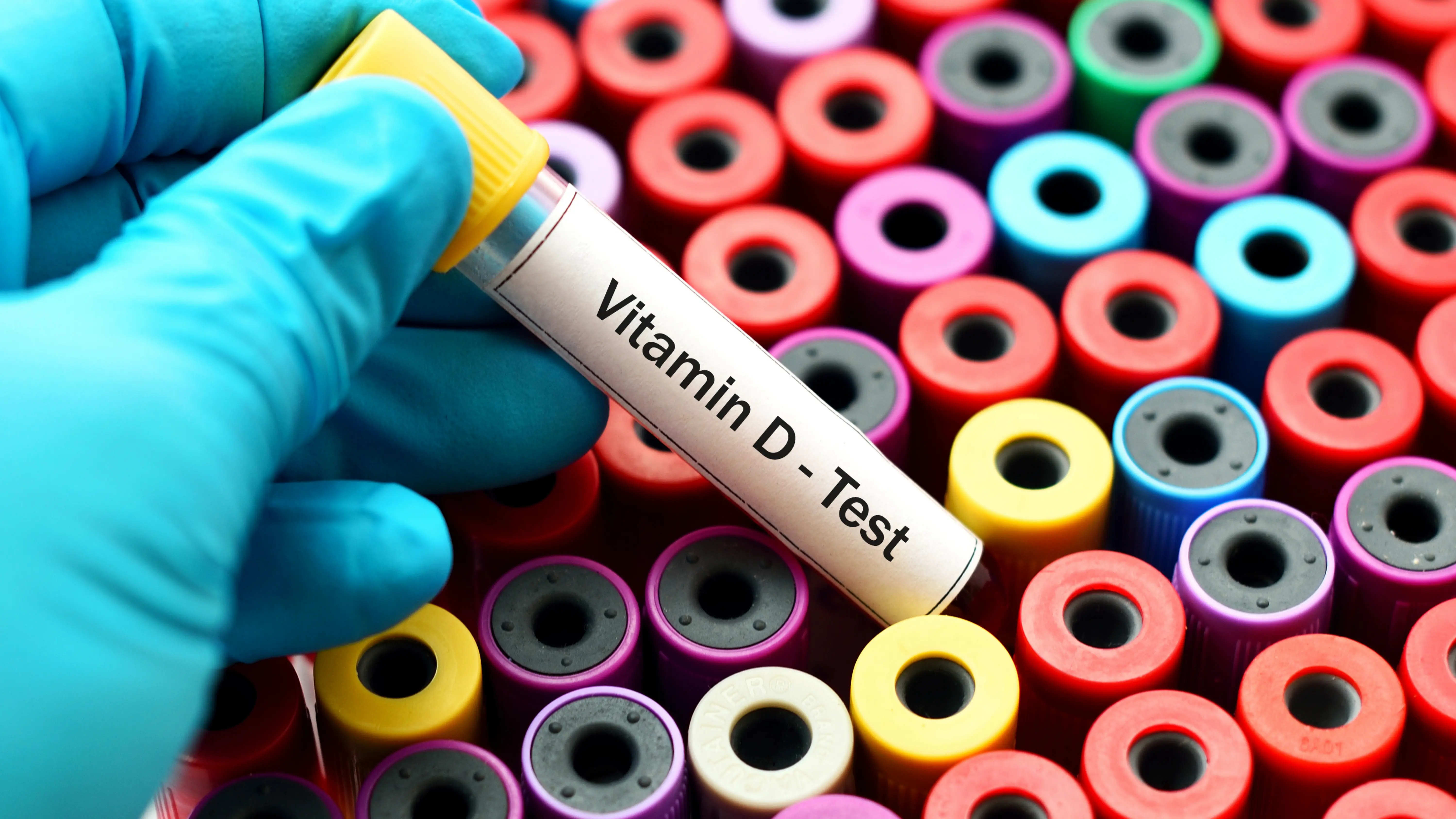 Vitamin D3 Test