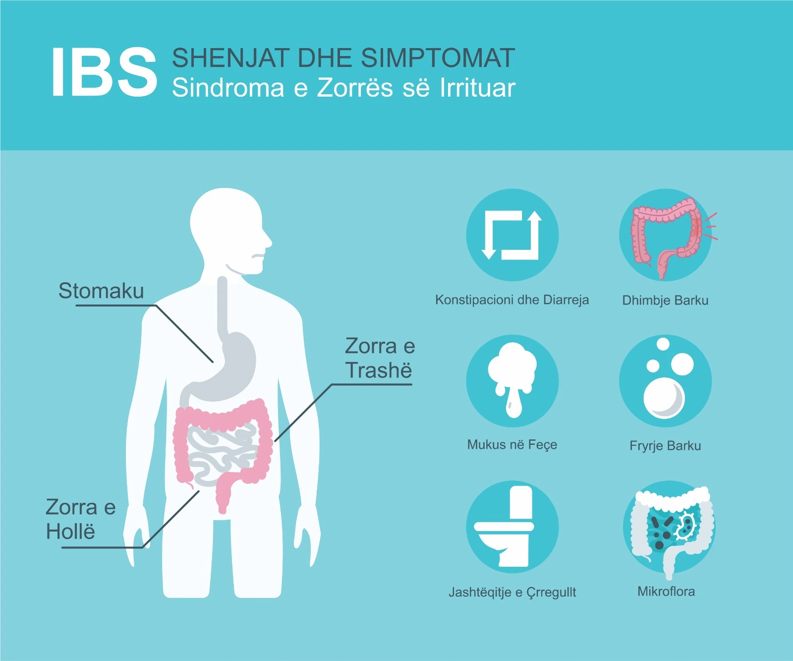 Sindroma e zorres se irrituar Klinika Kajo
